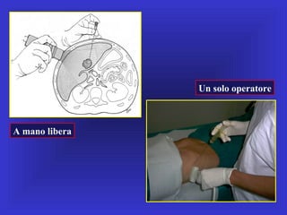 Un solo operatore
A mano libera
 