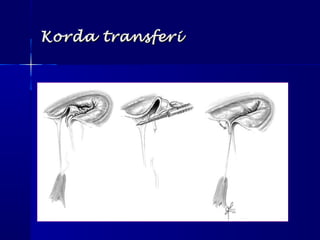 Korda transferiKorda transferi
 