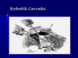 Robotik CerrahiRobotik Cerrahi
 