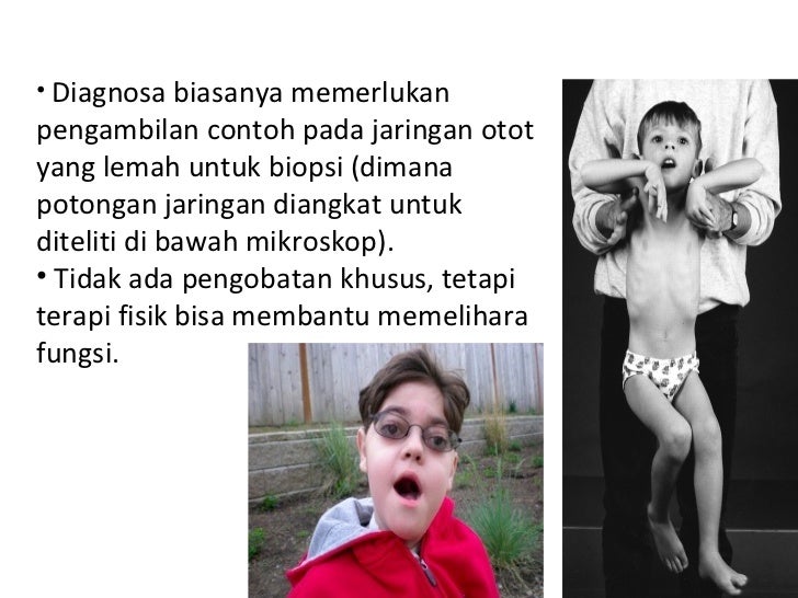 kelainan kongenital muskuloskeletalblog