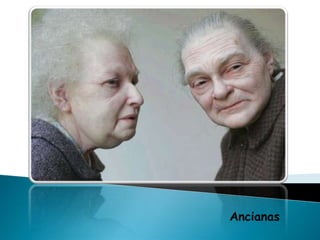 Ancianas
 