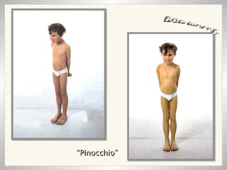 “ Pinocchio” RON MUECK 