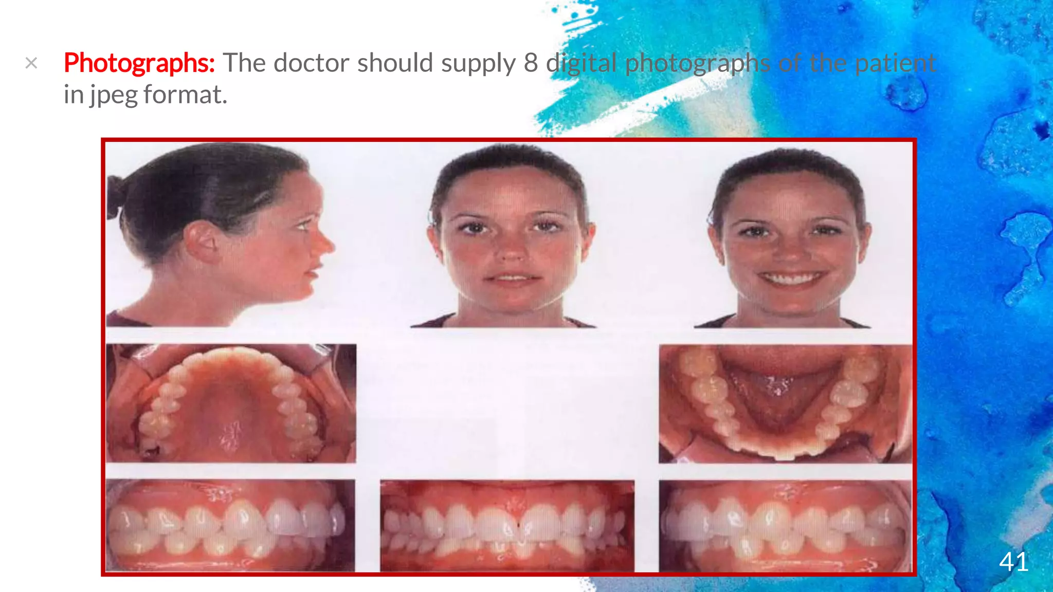 Clear aligner therapy and invisalign | PPTX