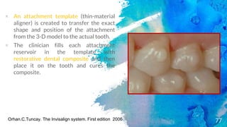 Clear aligner therapy and invisalign | PPTX | Dental Health | Diseases ...