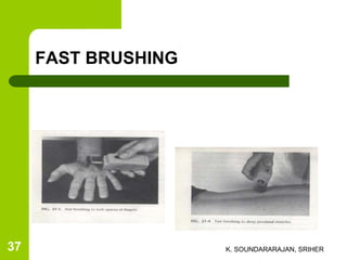 FAST BRUSHING
K. SOUNDARARAJAN, SRIHER37
 