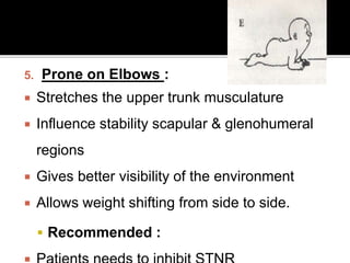 5. Prone on Elbows :
 Stretches the upper trunk musculature
 Influence stability scapular & glenohumeral
regions
 Gives better visibility of the environment
 Allows weight shifting from side to side.
 Recommended :
 