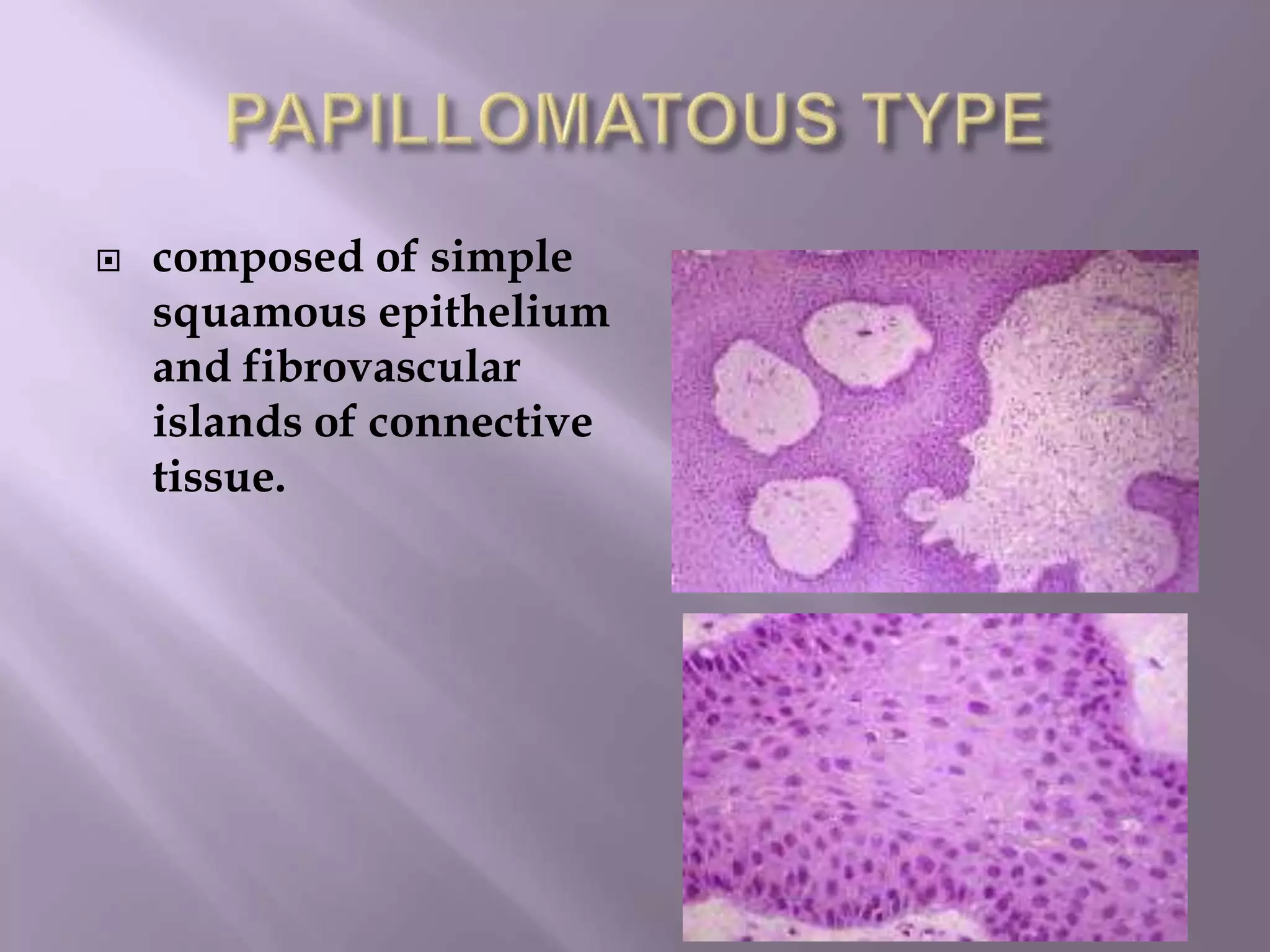  composed of simple
squamous epithelium
and fibrovascular
islands of connective
tissue.
 