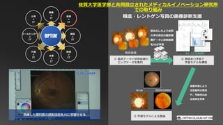 眼底画像 AI（人工知能）
① 臨床データと診断結果の
ビッグデータを集約
② 教師あり学習で
学習モデルを構築
匿名化した上で佐賀
大学の過去の臨床画
像データと診断結果
をAIが学習
深層学習により
注意個所の発見
や、可能性のあ
る疾病を列挙
糖尿病性網膜症緑内障
③ 学習モデルによる推論
眼底・レントゲン写真の画像診断支援
農業
×
IT
医療
×
IT
建設
×
IT
鉄道
×
IT
水産
×
IT
コールセンター
×
IT
小売
×
IT
介護
×
IT
佐賀大学医学部と共同設立されたメディカルイノベーション研究所
での取り組み
 