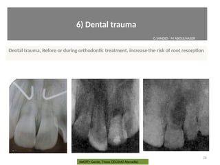 6) Dental trauma
Dental trauma, Before or during orthodontc treatment, increase the risk of root resorpton
26
AMORY Carole, These CECSMO Marseille)
O SANDID- M ABOULNASER
oussama sandid-oussama-sandid-olivier sandid-olivier-sandid-mohamad aboualnaser-mohamad aboualnser-sandid-aboualnaser -mohmad aboulnaser
External Root resorpton in Orthodontcs-oussama sandid- olivier sandid -o sandid-mohamad aboualnaser-mohamad aboulnaser-m aboualnaser 
 