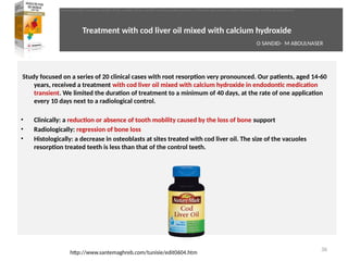 Treatment with cod liver oil mixed with calcium hydroxide
Study focused on a series of 20 clinical cases with root resorpton very pronounced. Our patents, aged 14-60
years, received a treatment with cod liver oil mixed with calcium hydroxide in endodontc medicaton
transient. We limited the duraton of treatment to a minimum of 40 days, at the rate of one applicaton
every 10 days next to a radiological control.
• Clinically: a reducton or absence of tooth mobility caused by the loss of bone support
• Radiologically: regression of bone loss
• Histologically: a decrease in osteoblasts at sites treated with cod liver oil. The size of the vacuoles
resorpton treated teeth is less than that of the control teeth.
36
http://www.santemaghreb.com/tunisie/edit0604.htm
O SANDID- M ABOULNASER
oussama sandid-oussama-sandid-olivier sandid-olivier-sandid-mohamad aboualnaser-mohamad aboualnser-sandid-aboualnaser -mohmad aboulnaser
External Root resorpton in Orthodontcs-oussama sandid- olivier sandid -o sandid-mohamad aboualnaser-mohamad aboulnaser-m aboualnaser 
 