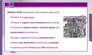 Smear Layer Modifications Root biomodification | PPT