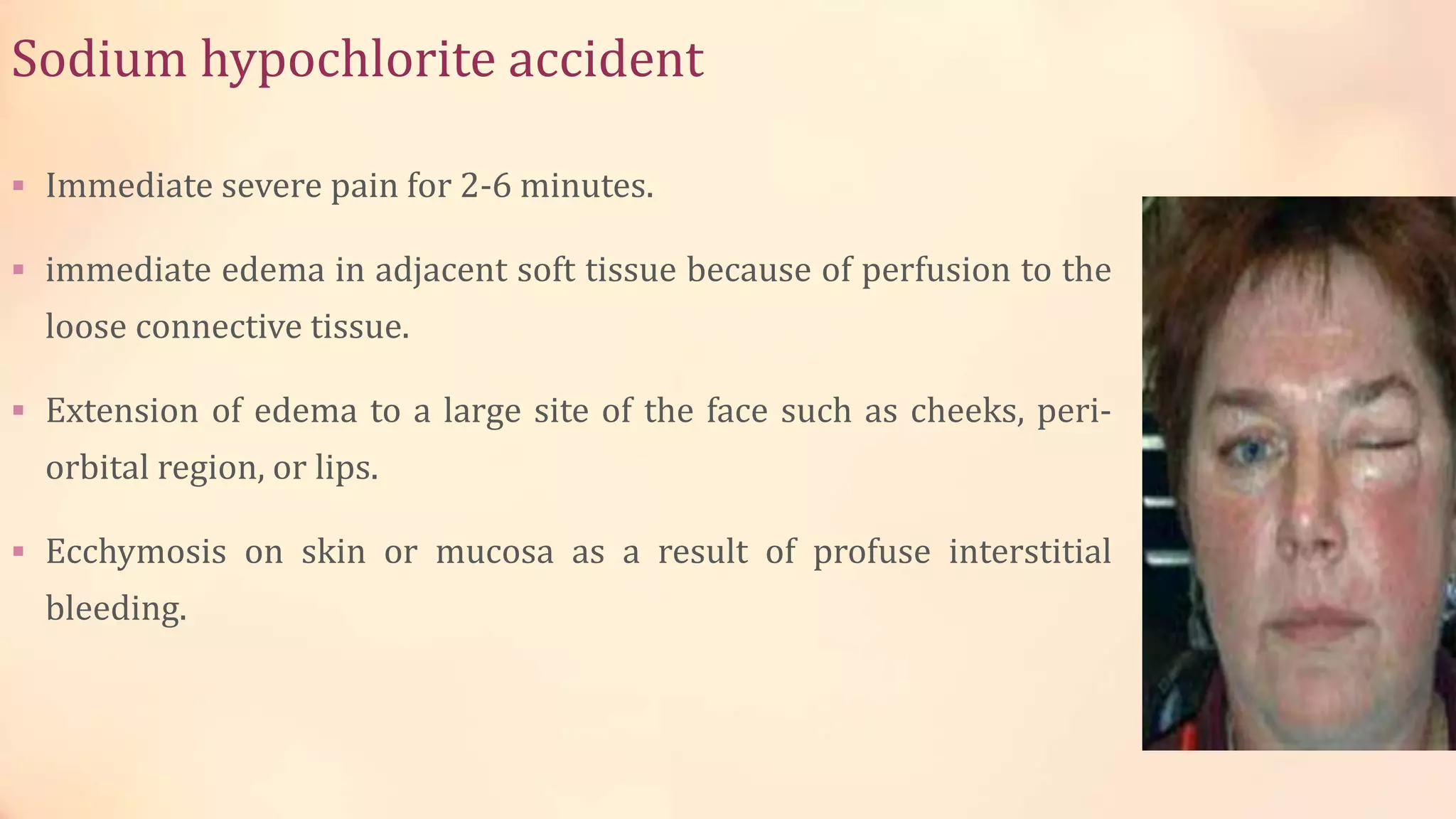 Sodium hypochlorite accident 
 Immediate severe pain for 2-6 minutes. 
 immediate edema in adjacent soft tissue because of perfusion to the 
loose connective tissue. 
 Extension of edema to a large site of the face such as cheeks, peri-orbital 
region, or lips. 
 Ecchymosis on skin or mucosa as a result of profuse interstitial 
bleeding. 
 