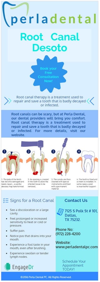 Root Canal Desoto 