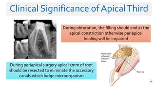 Impaired Roots rootcanalanatomy-190808050207.pptx