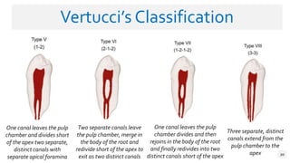 Vertuc Classification Root canal anatomy | PPTX