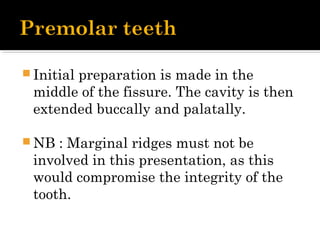  Initial preparation is made in the
middle of the fissure. The cavity is then
extended buccally and palatally.
 NB : Marginal ridges must not be
involved in this presentation, as this
would compromise the integrity of the
tooth.
 