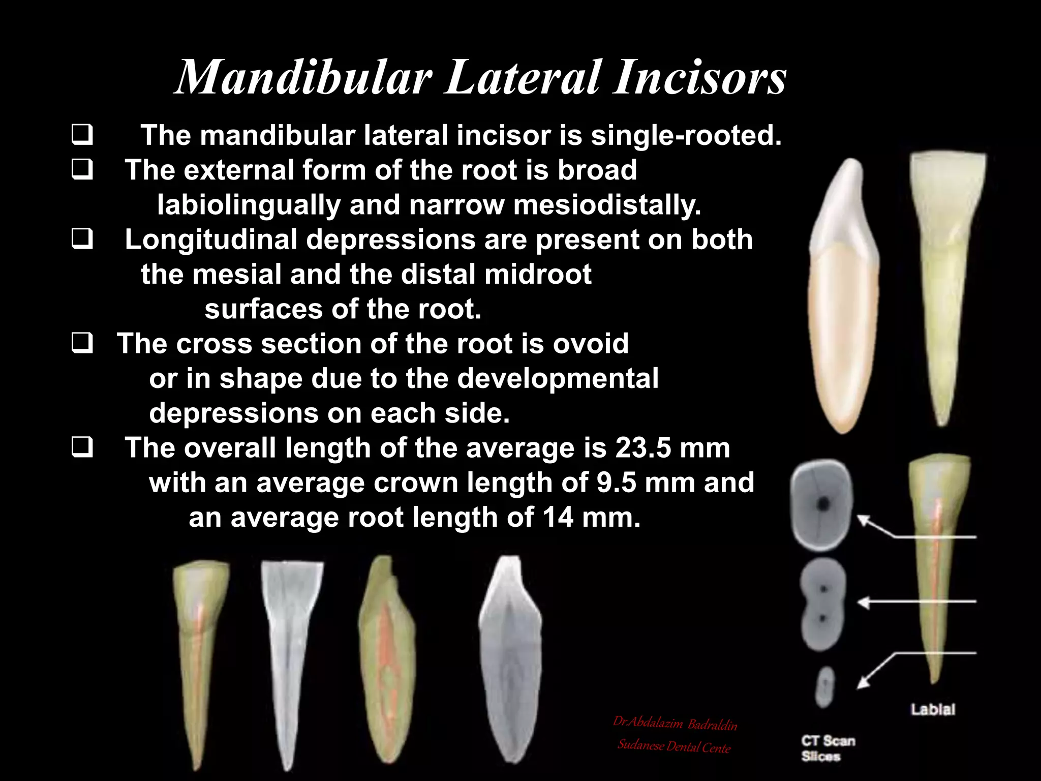 Root canal anatomy and configuration project mandibular teeth ...