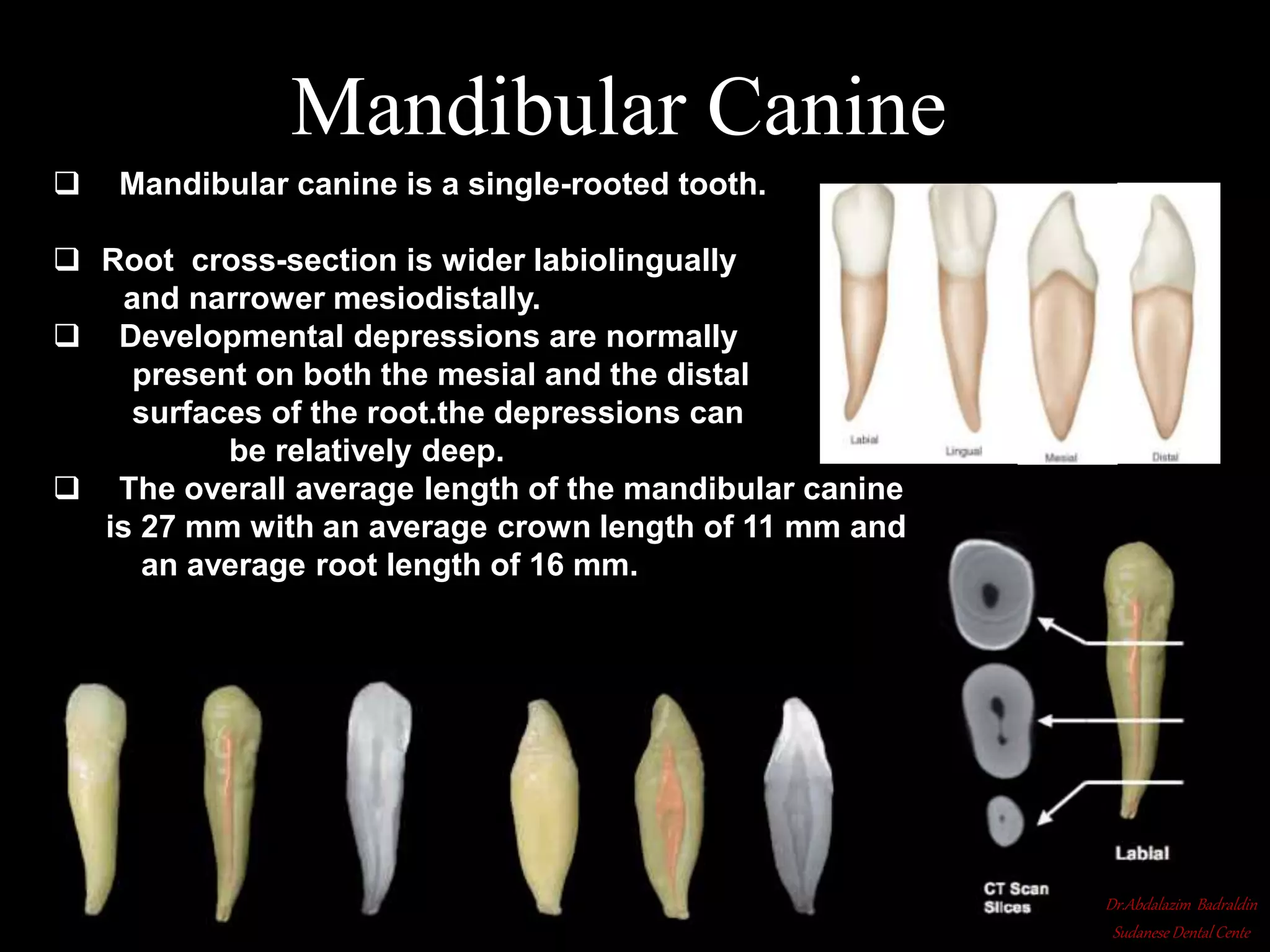 Root canal anatomy and configuration project mandibular teeth ...