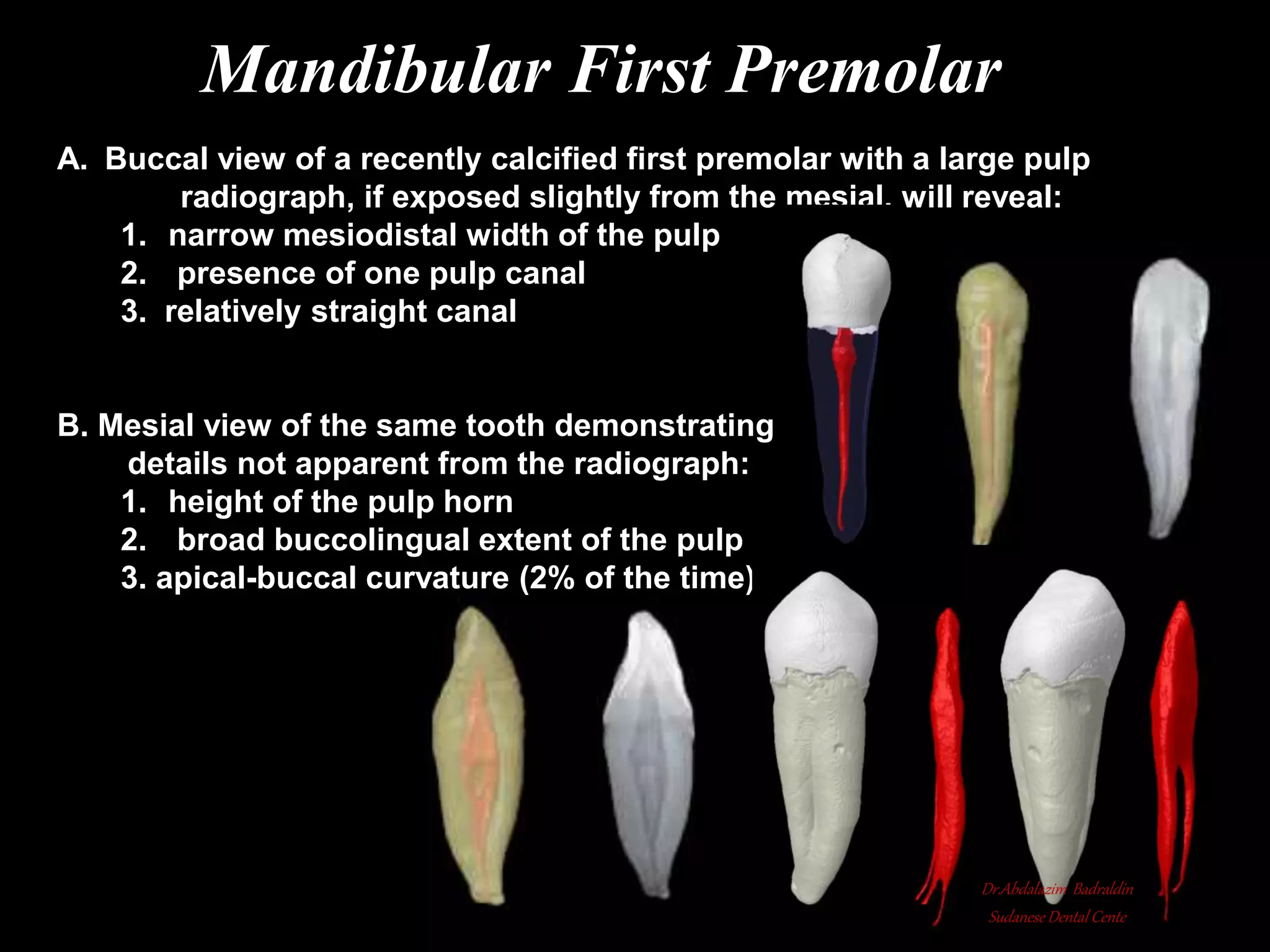 Root canal anatomy and configuration project mandibular teeth ...