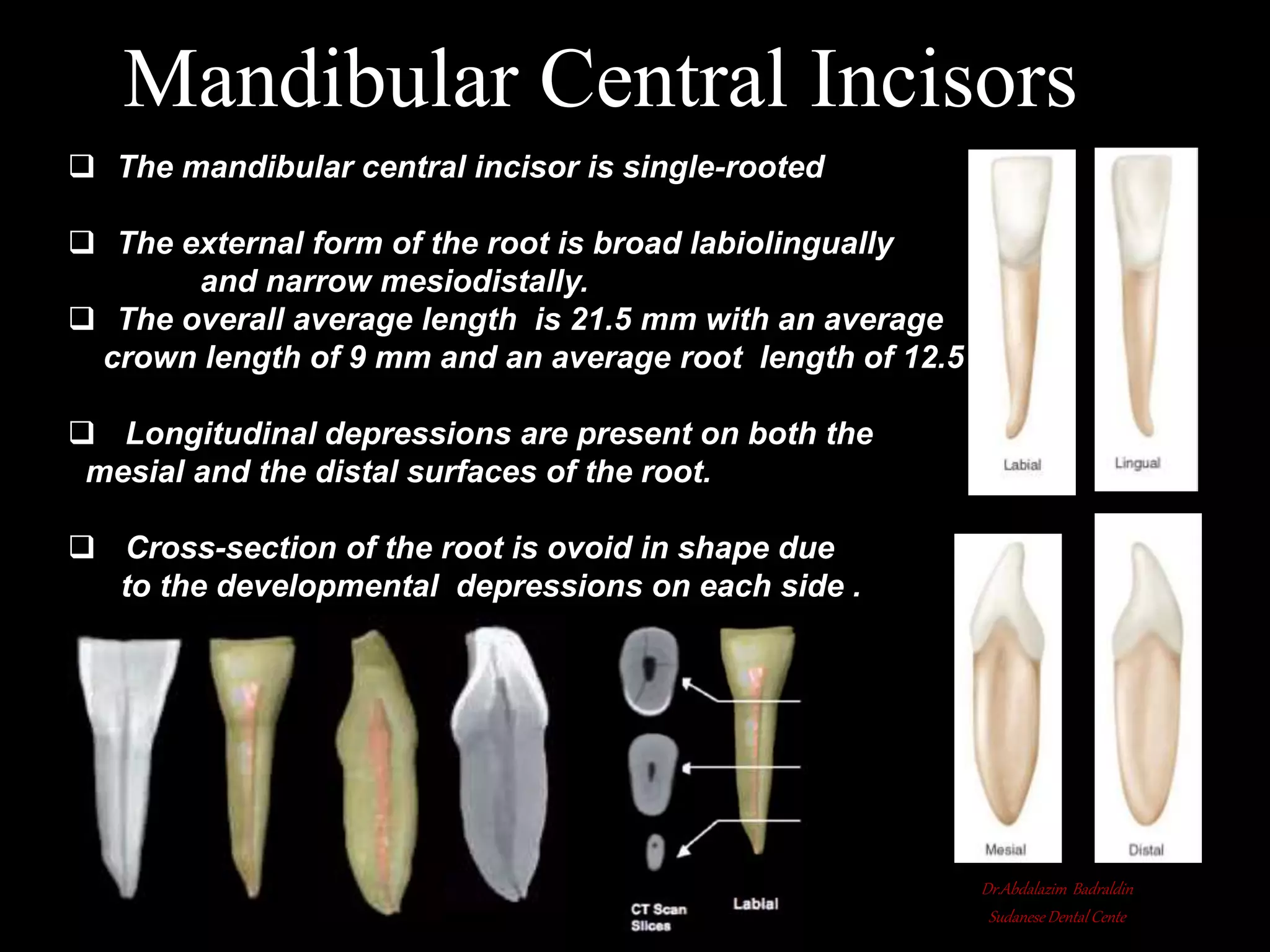 Root canal anatomy and configuration project mandibular teeth ...