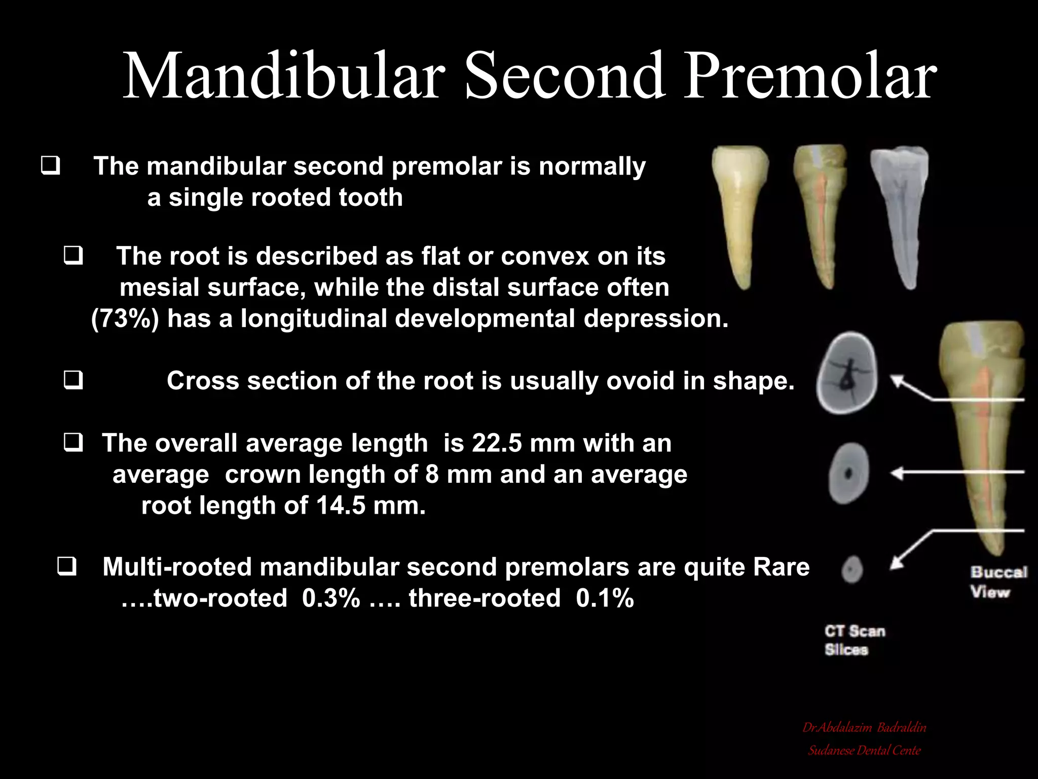 Root canal anatomy and configuration project mandibular teeth ...