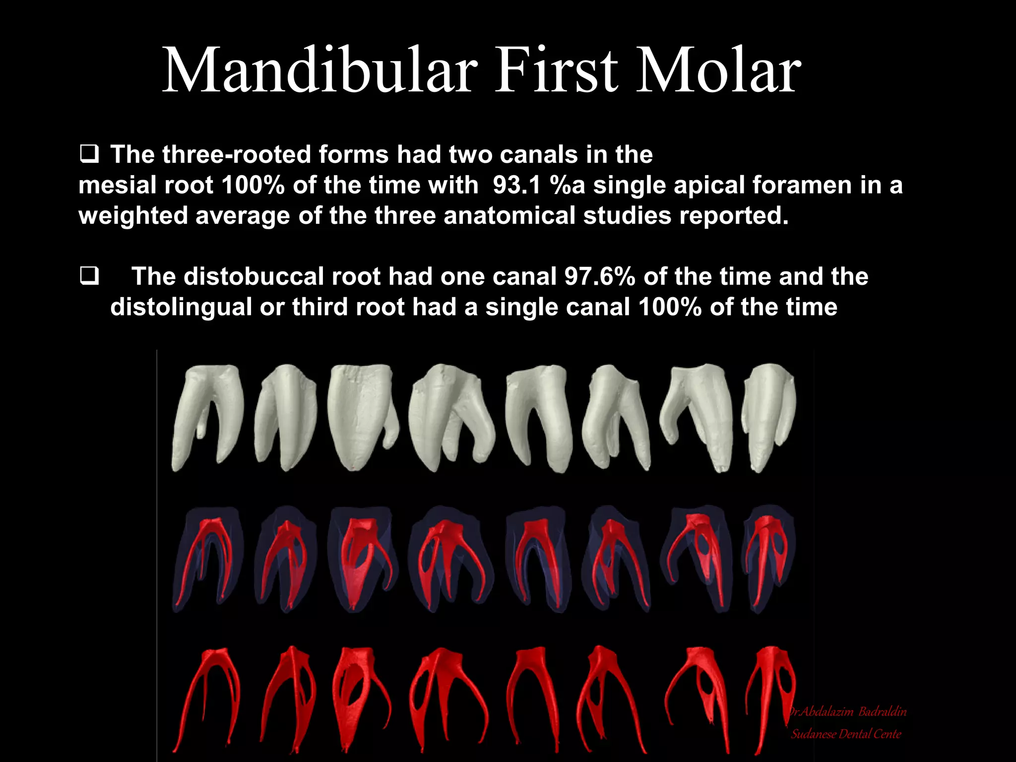 Root canal anatomy and configuration project mandibular teeth ...