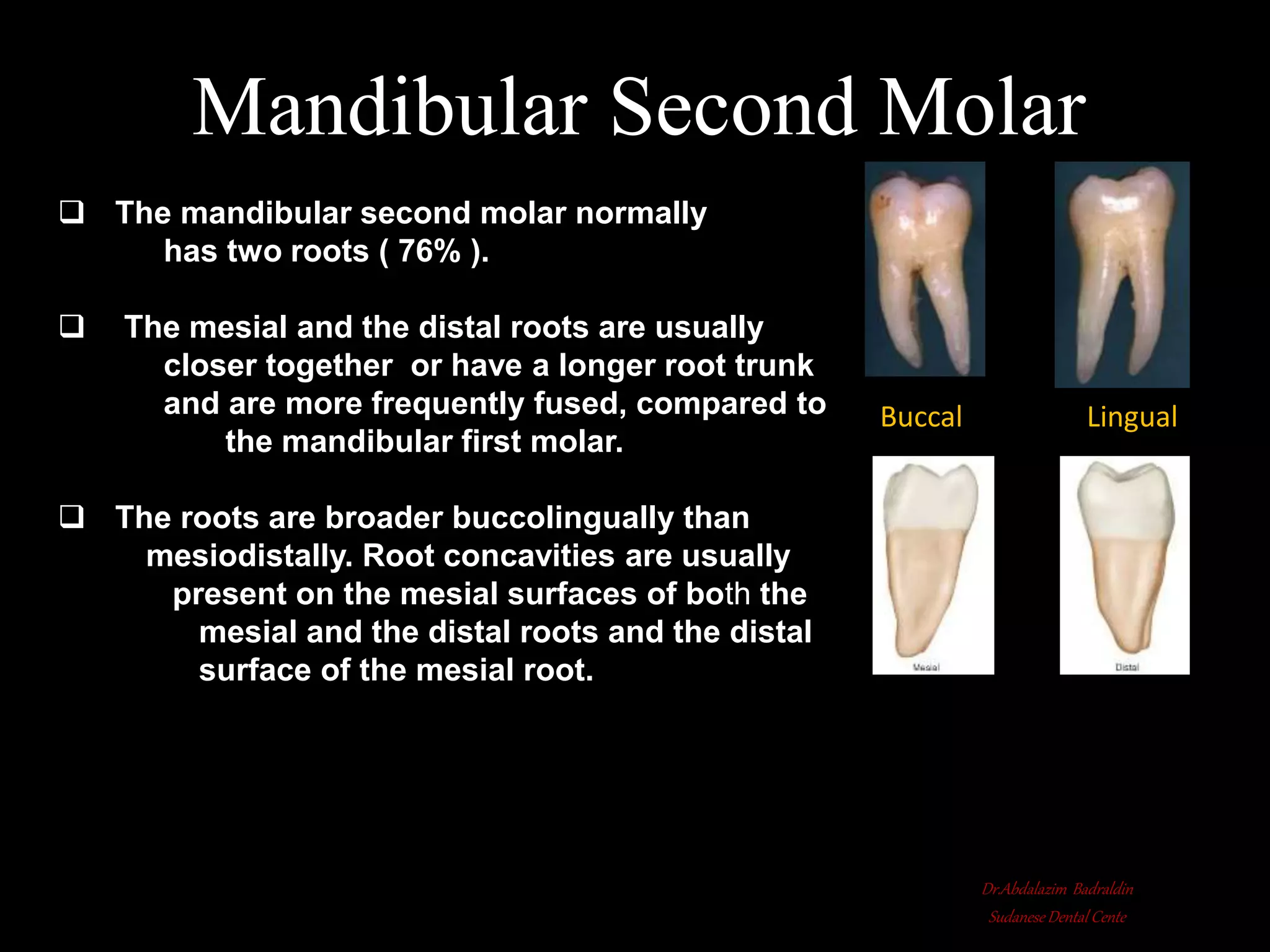 Root canal anatomy and configuration project mandibular teeth ...