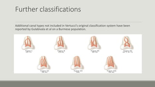 Further classifications
Additional canal types not included in Vertucci’s original classification system have been
reported by Gulabivala et al on a Burmese population.
 