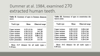 Dummer at al. 1984, examined 270
extracted human teeth.
 