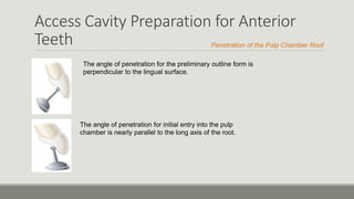 Access Cavity Preparation for Anterior
Teeth
The angle of penetration for the preliminary outline form is
perpendicular to the lingual surface.
The angle of penetration for initial entry into the pulp
chamber is nearly parallel to the long axis of the root.
Penetration of the Pulp Chamber Roof
 