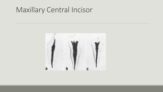 Maxillary Central Incisor
 