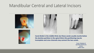 Mandibular Central and Lateral Incisors
Canal divide in the middle third, but these canals usually reunite below
the dentine partition in the apical third, this partitioning may be
incomplete and cross channels may connect the two canals.
Turner, Textbook of
operative dentistry by
various
authors 1911
 