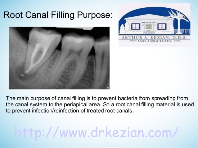 root canal filling material