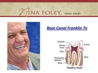 Root Canal Franklin Tn
 