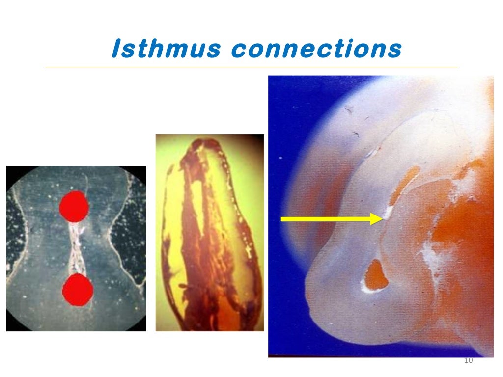 Root canal irrigants and devices