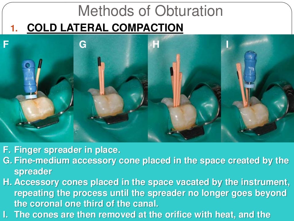 Root canal obturation timing materials and techniques