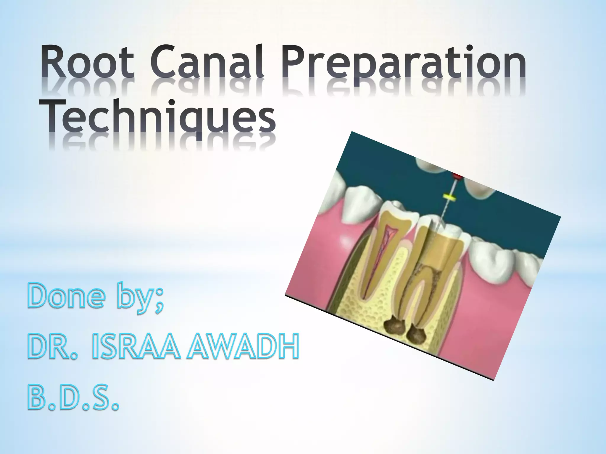 Root canal preparation techniques _ endodontic treatment PPT