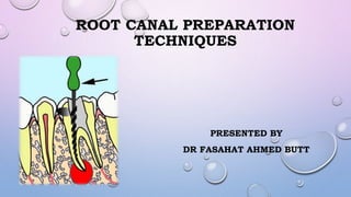 ROOT CANAL PREPARATION
TECHNIQUES
PRESENTED BY
DR FASAHAT AHMED BUTT
 