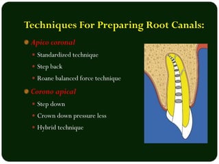 ROOT CANAL PROCEDURE.pdf