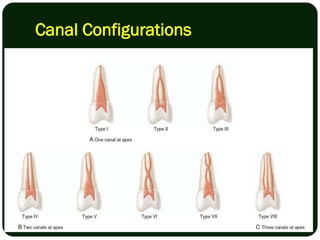 ROOT CANAL PROCEDURE.pdf