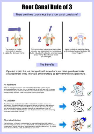 Benefits of Root Canals