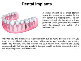 Dental Implants
A dental implant is a small titanium
screw that serves as an anchor for the
root portion of a missing tooth. The new
implant is fixed into the upper or lower
jaw bone, which gives your replacement
tooth the strength and stability of a
natural tooth.
Whether you are missing one or several teeth due to injury, disease or decay; you
may be a candidate for dental implants, which can be used to replace your missing
teeth.They will look, feel, and function like your natural teeth. Patients are usually
concerned with their age and wonder if they are too old for dental implants, but age is
not a deciding factor, overall health is.
 
