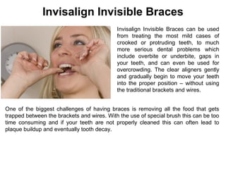 Invisalign Invisible Braces
Invisalign Invisible Braces can be used
from treating the most mild cases of
crooked or protruding teeth, to much
more serious dental problems which
include overbite or underbite, gaps in
your teeth, and can even be used for
overcrowding. The clear aligners gently
and gradually begin to move your teeth
into the proper position – without using
the traditional brackets and wires.
One of the biggest challenges of having braces is removing all the food that gets
trapped between the brackets and wires. With the use of special brush this can be too
time consuming and if your teeth are not properly cleaned this can often lead to
plaque buildup and eventually tooth decay.
 