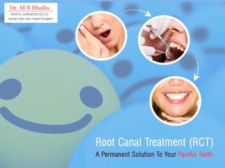 Root Canal Treatment (RCT)
A Permanent Solution To Your
Painful Teeth
 