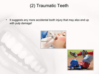 (2) Traumatic Teeth
• It suggests any more accidental tooth injury that may also end up
with pulp damage!
 