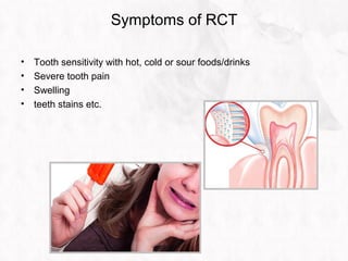 Symptoms of RCT
• Tooth sensitivity with hot, cold or sour foods/drinks
• Severe tooth pain
• Swelling
• teeth stains etc.
 