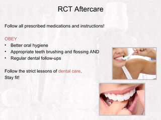 RCT Aftercare
Follow all prescribed medications and instructions!
OBEY
• Better oral hygiene
• Appropriate teeth brushing and flossing AND
• Regular dental follow-ups
Follow the strict lessons of dental care.
Stay fit!
 