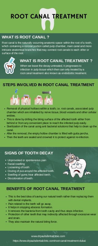 ROOT CANAL TREATMENT
Root canal is the naturally occurring anatomic space within the root of a tooth,
which containing a coronal portion called pulp chamber, main canal and more
intricate anatomical branches that may connect root canals to each other or
surface of the root.
When we leave the decay untreated, it progresses to
infection in pulp tissue which then can only treated by a
root canal treatment also known as endodontic treatment.
WHAT IS ROOT CANAL TREATMENT ?
WHAT IS ROOT CANAL ?
STEPS INVOLVED IN ROOT CANAL TREATMENT
Removal of physical hollows within a tooth, i.e. root canals, associated pulp
chamber which are inhabited by nerve tissue, blood vessels and other cellular
entities.
This is done by drilling the biting surface of the affected tooth either from
behind or from any convenient place to reach the infected pulp easily.
Sterilization of the canal using anti bacterial solutions that help to clean up the
canal.
After the removal, the empty hollow chamber is filled with gutta percha.
Then the teeth are sealed and crowned it to protect against re-infection.
BENEFITS OF ROOT CANAL TREATMENT
This is the best idea of saving our natural teeth rather than replacing them
with dental implants.
Pain related to the teeth will go away.
It helps in stopping abscess formation.
It removes the bacteria from tooth cavity and thus stops infection.
Protection of other teeth that may indirectly affected through excessive wear
and strain.
They also maintain the natural biting force.
Unprovoked or spontaneous pain
Facial swelling
Loosening of tooth
Oozing of pus around the affected tooth.
Swelling of gums near affected teeth.
Discoloration of teeth
SIGNS OF TOOTH DECAY
www.drpaulsdentalclinic.com
https://www.drpaulsdentalclinic.com/root-canal-treatment-dubai
 