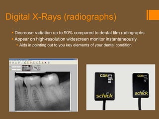 Digital X-Rays (radiographs)
  Decrease radiation up to 90% compared to dental film radiographs
  Appear on high-resolution widescreen monitor instantaneously
    Aids in pointing out to you key elements of your dental condition
 