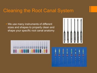 Cleaning the Root Canal System

  We use many instruments of different
   sizes and shapes to properly clean and
   shape your specific root canal anatomy
 
